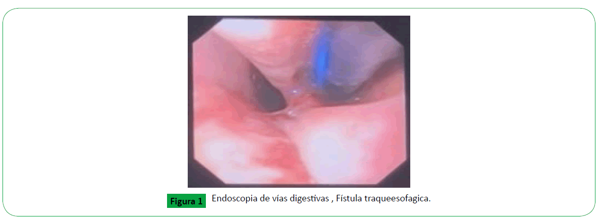 archivosdemedicina-traqueesofagica